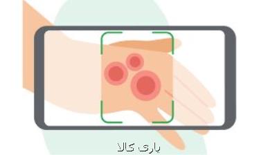 طراحی برنامه ای برای تشخیص و درمان بیماری های پوستی