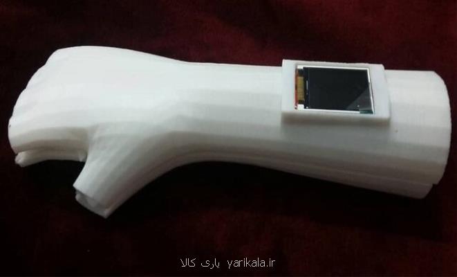 آتل و اسپلینت ارتوپدی هوشمند محققان كشور ثبت بین المللی شد