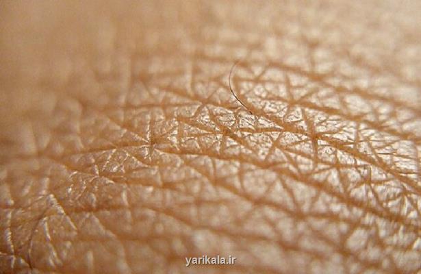 ابداع یك پوست آزمایشگاهی با قابلیت رویش مو